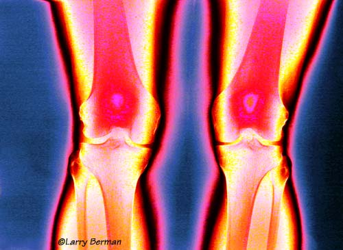 Color infrared medical photographs by Larry Berman